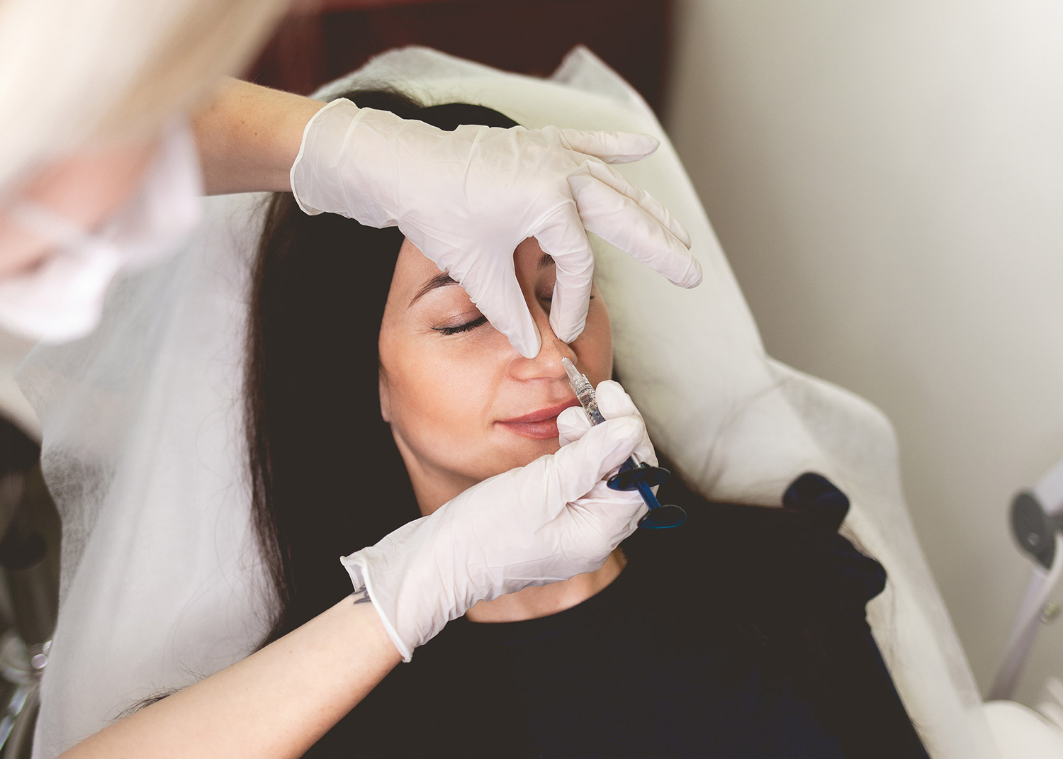 Rhinoplastie liquide : tout ce qu'il faut savoir sur le remodelage du nez sans chirurgie