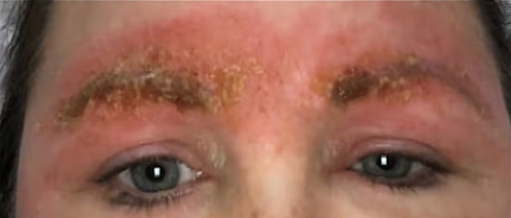 Séance microblading sourcils tourne cauchemar