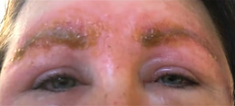 Séance microblading sourcils tourne cauchemar