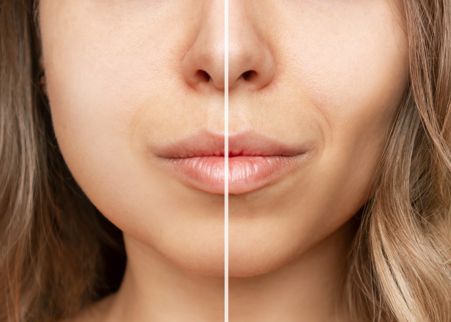 Se faire retirer le gras des joues : la dernière chirurgie esthétique (tristement) tendance