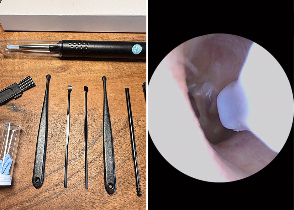 Caméra pour nettoyer les oreilles: on a testé et voici notre honnête avis