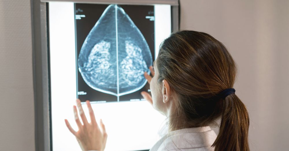 Will the age for breast cancer screening soon be lowered to 40?  – Nuovo Ya