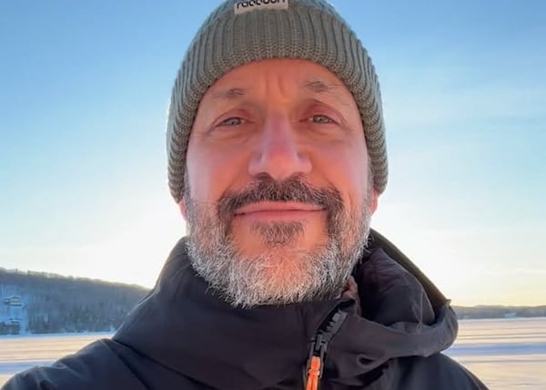 Martin Matte a reçu une décharge électrique et nous montre les dégâts