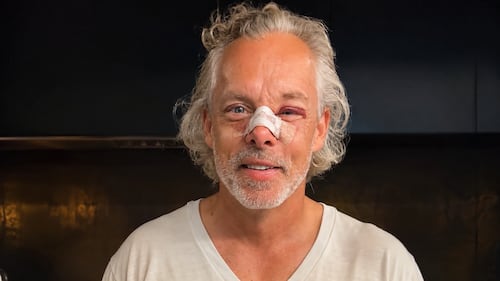«Je n’ai pas mangé une volée»: François Lambert a été opéré au visage