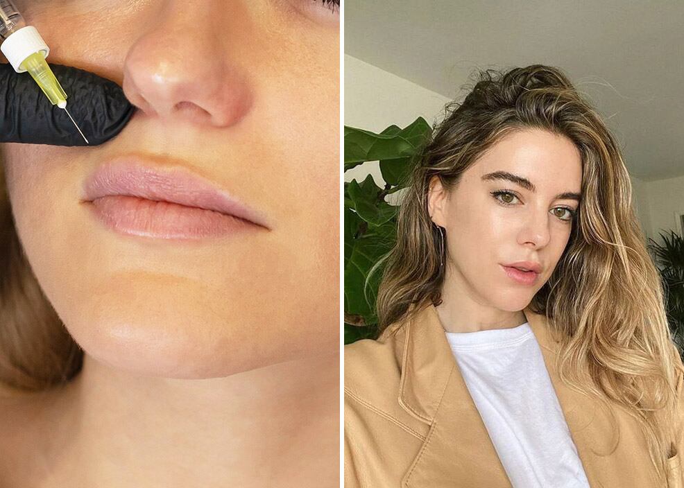 melatonin vs melanotan Melanotan 1 vs Melanotan 2