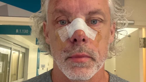 François Lambert: voici à quoi ressemblait son cancer de la peau