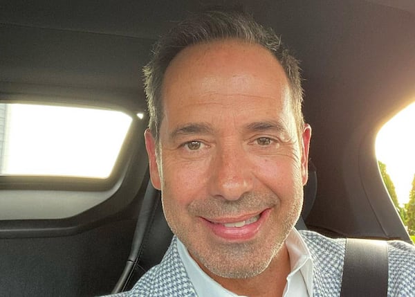 Un an après sa greffe de cheveux, José Gaudet nous montre les impressionnants résultats