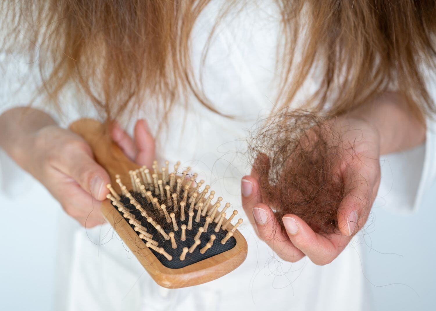 Perte de cheveux: quand s'inquiéter?