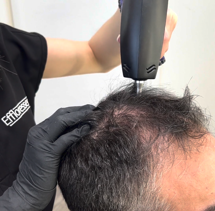 Lot De 200 Filets à Cheveux Pour Service Alimentaire, Invisibles Et Respirants, En Nylon Solide Et Durable, Pour Une Utilisation - Au Quotidien