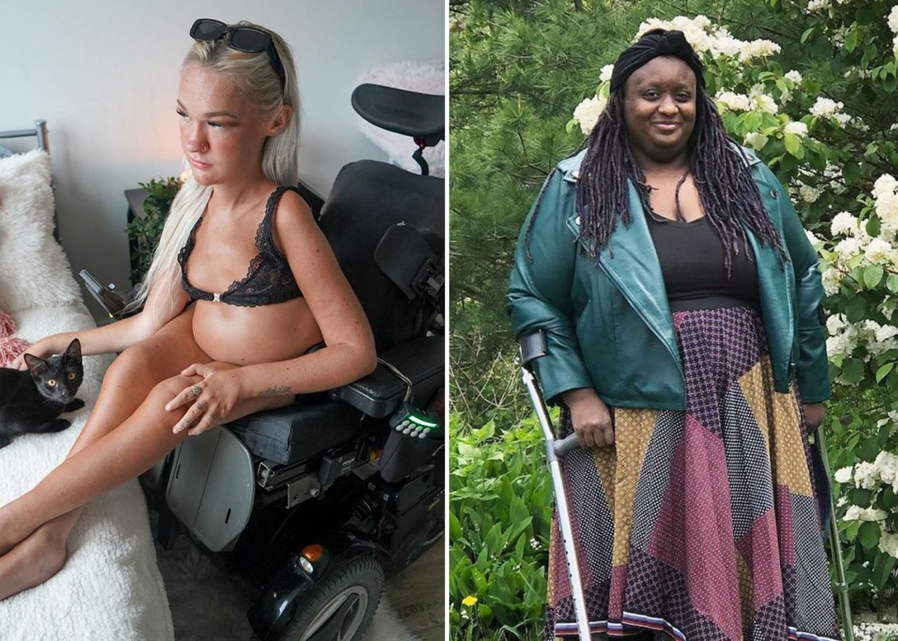 7 femmes qui affichent leur handicap et différence avec fierté